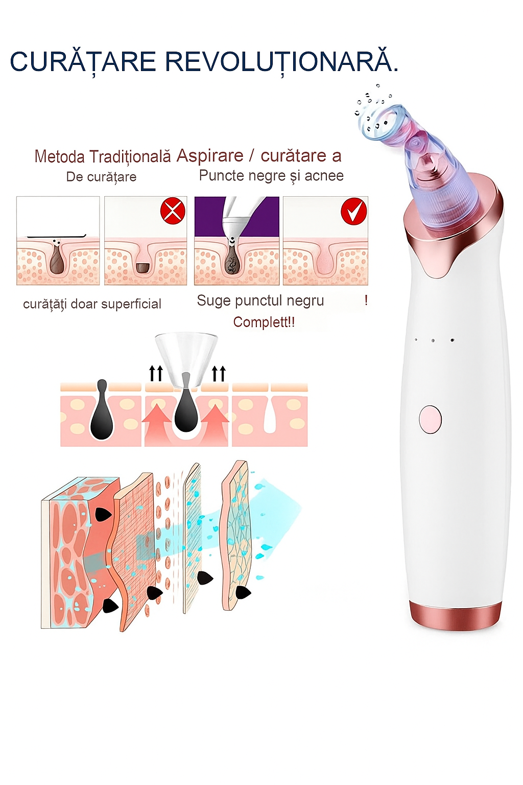🥇 PoreClean Pro® – Mii de români îl folosesc deja pentru a scăpa de punctele negre și coșuri! 😱💨